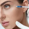Manfaat dan Efek Samping Suntik Botox