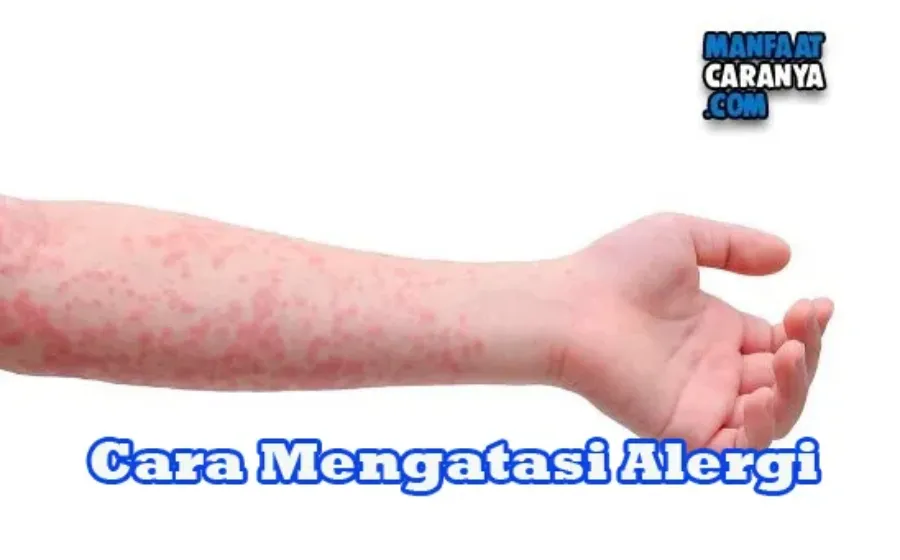 Cara Mengatasi Alergi Pada Tubuh Secara Alami