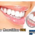 Tisp Memutihkan Gigi Secara Alami yang Praktis