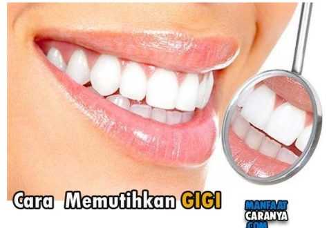 Tisp Memutihkan Gigi Secara Alami yang Praktis