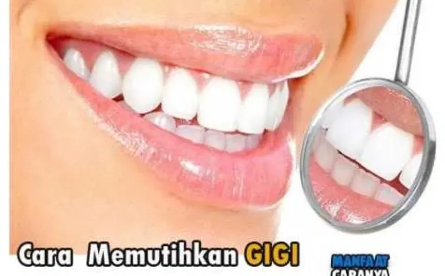 Tisp Memutihkan Gigi Secara Alami yang Praktis