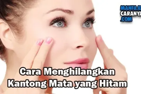 Cara Menghlangkan Kantong Mata Yang Hitam