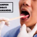Cara Mengobati Amandel