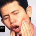 Cara Mengobati Sakit Gigi