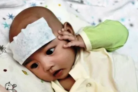 Cara Menurunkan Demam Anak Tanpa Obat