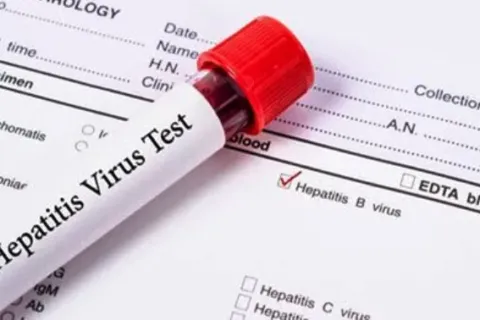 Cara Mengobati Hepatitis B Secara Alami