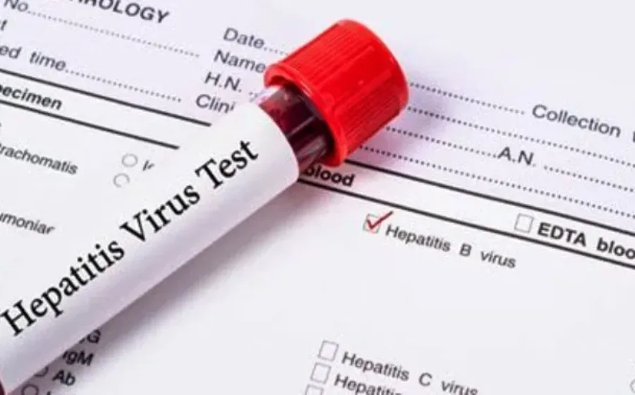 Cara Mengobati Hepatitis B Secara Alami