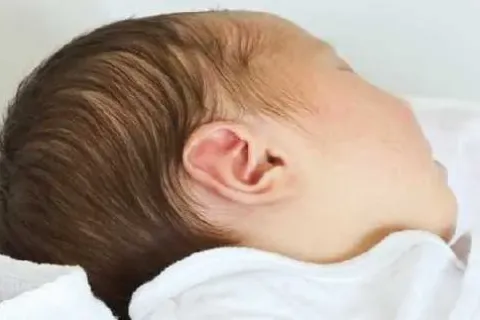Cara Membersihkan Cerumen Pda Bayi Agar Aman dan Nyaman