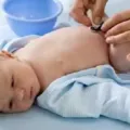 Cara Merawat Tali Pusar Bayi