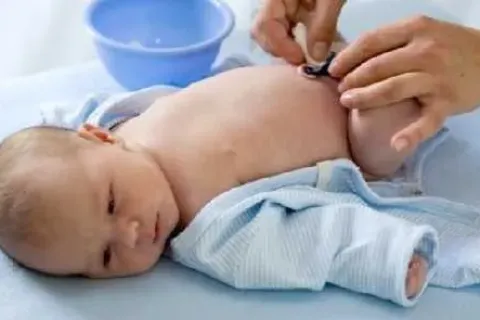 Cara Merawat Tali Pusar Bayi