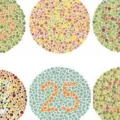 5 Penyebab Buta Warna dan Penanganannya