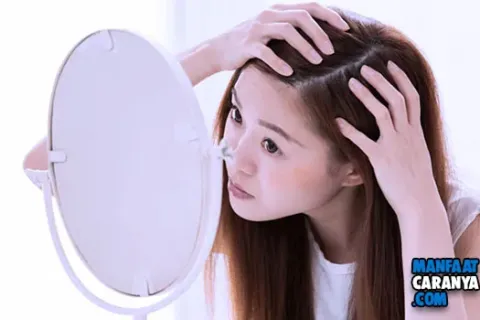 Cara Cepat Hilangkan Ketombe Dengan Baking Soda Dan Cuka