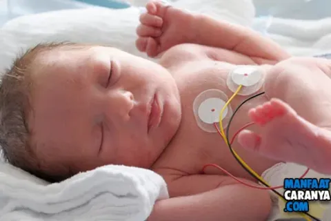 5 Tips Merawat Bayi Prematur