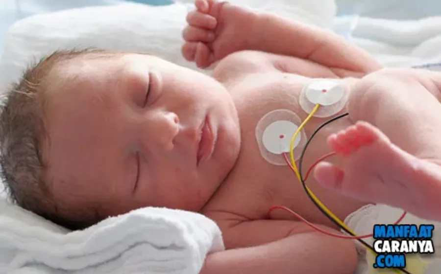 5 Tips Merawat Bayi Prematur