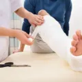 6 Tips Cepat Sembuh Dari Patah Tulang