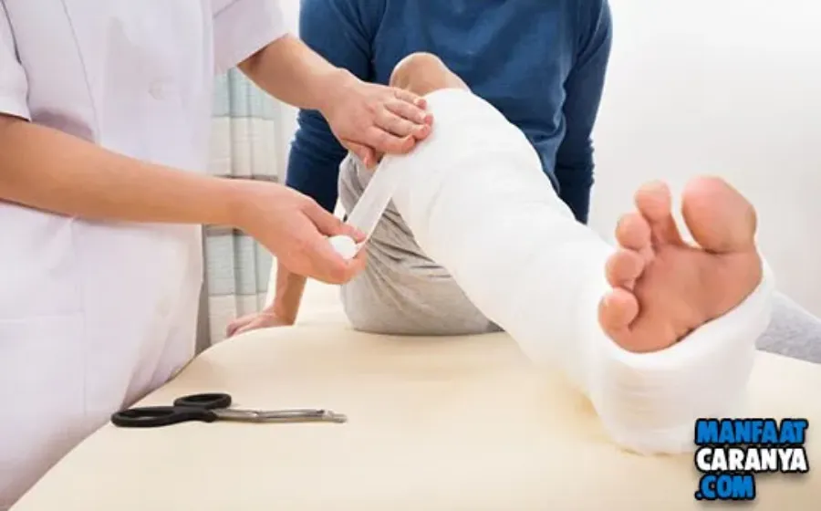 6 Tips Cepat Sembuh Dari Patah Tulang