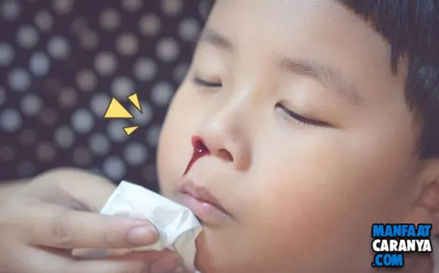 Penyebab dan Cara Mengatasi Mimisan Pada Anak