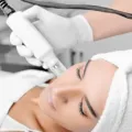 Tampil Cantik Dan Awet Muda Dengan Mesoterapy