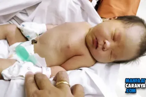 Tips Mengatasi Penyakit Kuning Pada Bayi Baru lahir