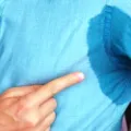Ketahui Berbagai Penyebab Ketiak Basah dan Cara Mengatasinya