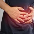 Obat Herbal Asam Lambung Paling Ampuh dan Manjur