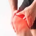 Cara Menurunkan Asam Urat secara Alami yang Bisa Dicoba
