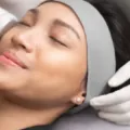 Jenis Treatment Klinik Kecantikan ERHA Clinic