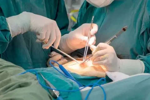 Lawan Obesitas Dengan Bariatik Surgery, Operasi Pemotongan Lambung Yang Viral