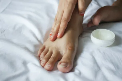 Perawatan kaki agar halus dengan mengoleskan pelembap pada bagian tumit